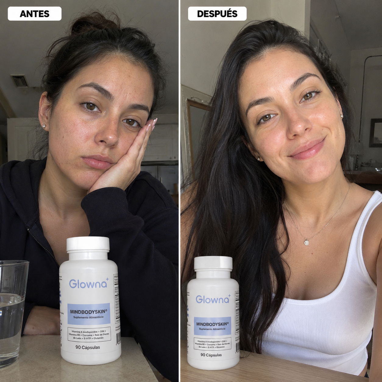 Glowna® Sistema anti-acné hormonal